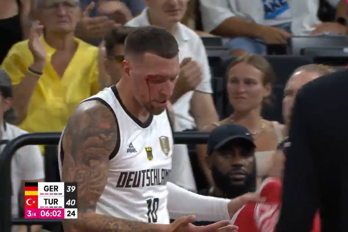 Celown and bloody: fright for German stars