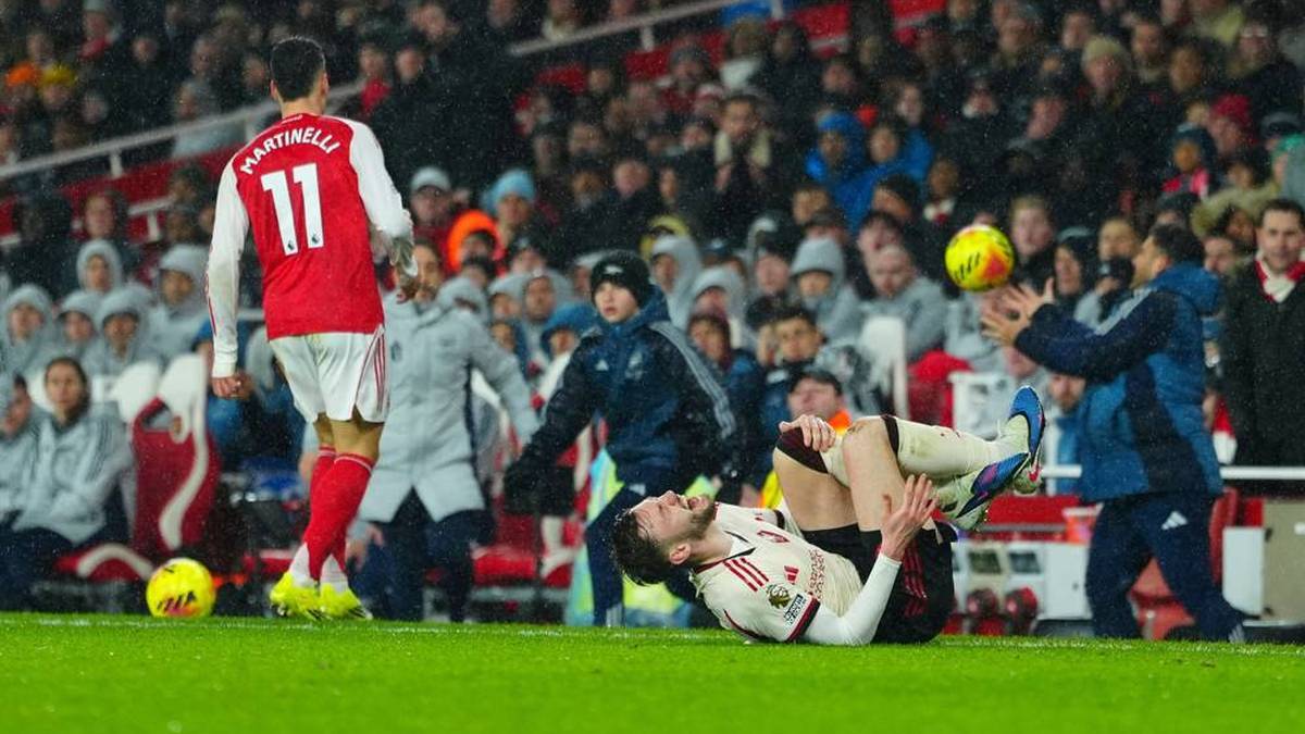 Conor Bradley (R) is out with a knee injury